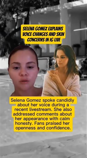 Selena Gomez Explains Voice Changes and Skin Concerns in IG Live