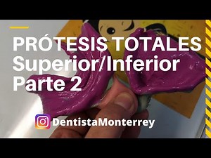 PASOS Prácticos #ProtesisTotales 👅Parte2 Cucharillas /Impresión dental #Dentaduracompleta #dental