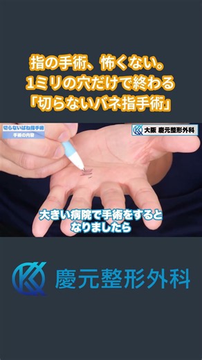 指の手術、怖くない。1ミリの穴だけで終わる「切らないバネ指手術」