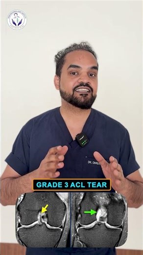 Do You Need Surgery in ACL Injury? | जानिए पूरी सच्चाई #aclinjury