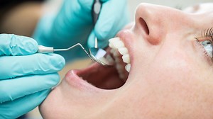 Cost of NHS dental treatments increase by up to £13 - including check ups