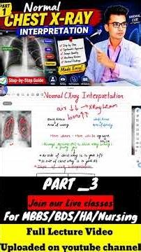 part 3 Chest X-Ray Made Easy! 🩻