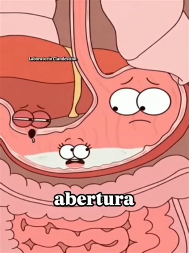 Estenosis Pilórica: ¿Por qué vomitan los bebés? 🍼