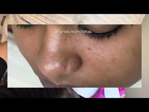 Iba a faciales y no le indicaban ni un limpiador😳 Así abordo una piel grasa sin rutina previa