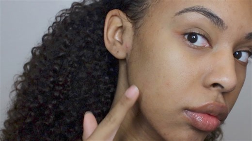Overnight clear skin: My natural acne & scar routine revealed!