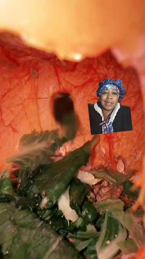 UHE eaters oyeeeeeeeeeeeeeeeee | Gbola and kpekus activist