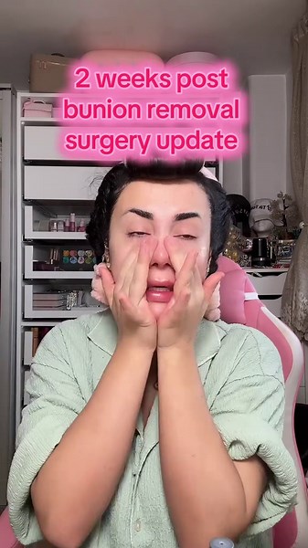 My bunion surgery took a scary turn two weeks post op