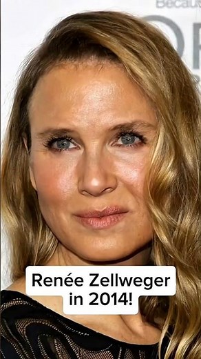 The Truth Behind Renée Zellweger’s 2014 Face Change #CelebritySurgery #BeforeAfter
