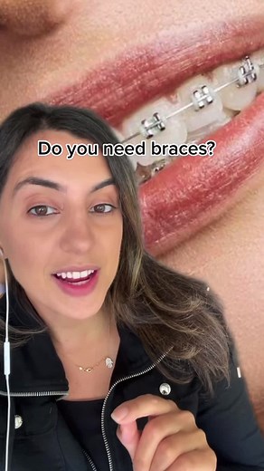 Do You Need Braces? | Signs, Symptoms, and Solutions
