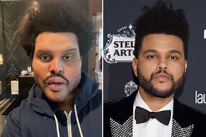The Weeknd's 'plastic surgery' reflects celebrities 'manipulating' themselves