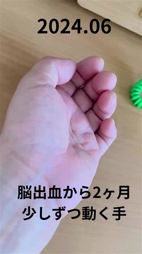 脳出血から2ヶ月の頃 手首の力も入らず 手を保つ事さえ難しかった ここから2年‥‥ 今、私は片麻痺の手で ドット曼荼羅を描いてます。 #脳出血 #脳出血リハビリ #片麻痺でも幸せな生き方 #片麻痺を受け入れる #自分を幸せにする方法