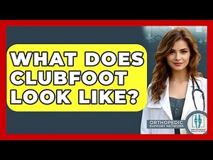 What Does Clubfoot Look Like? - Orthopedic Support Network