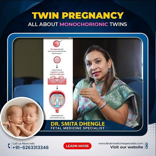 All About Monochorionic Twins | Twins Pregnancy | Dr. Smita Dhengle