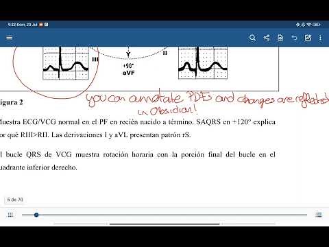 Obsidian Handwritten Notes quick demo