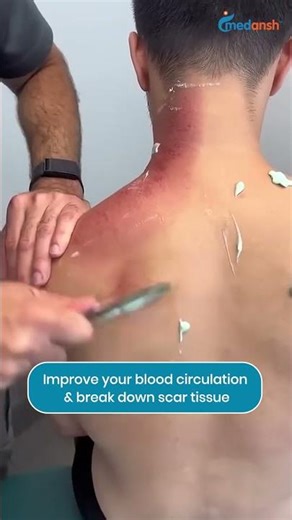 IASTM Tools | Stainless Steel Physiotherapy & Chiro Aid #physiotherapist