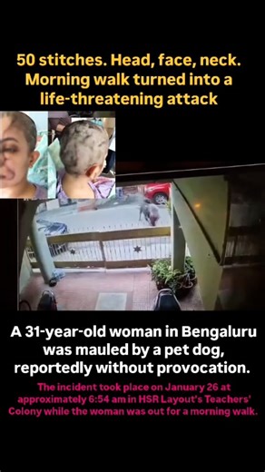 Namma HSR | Bengaluru ❤️ on Instagram: "Source : @karnatakaportfolio_ The dog reportedly attacked without provocation, biting her on the neck. When a man rushed to her rescue, the dog turned on him as well.Footage shows the man grabbing the dog by the neck to pull it away from the victim. While the man struggled with the animal, the woman managed to get up, retreat indoors, and shut the gate behind her. Follow @hsr_layout for more updates.! #hsr #hsr_layout #hsrlayout #bengaluru #nammahsr"