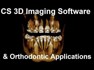 CS 3D Imaging Software and Orthodontic Applications