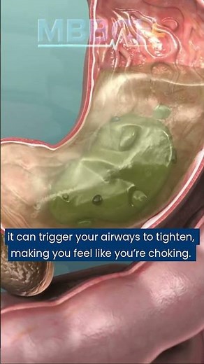 Why Some People Wake Up Gasping for Air (And It’s Not Just Sleep Apnea)