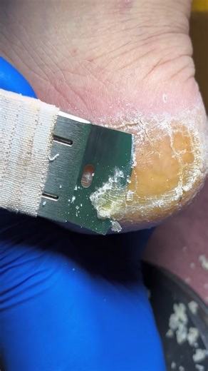 1M views · 5.1K reactions | Stress relief #pedicure | Nail Salon | Facebook