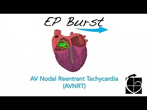 EP Burst: AVNRT