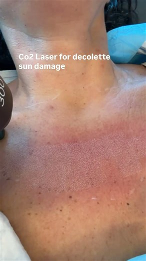 Advanced skin care at our practice with Dr Madnani #glassskin ￼