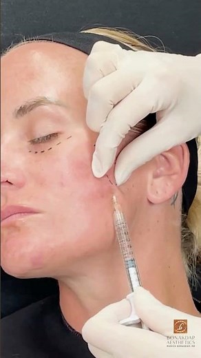 Injecting CK4