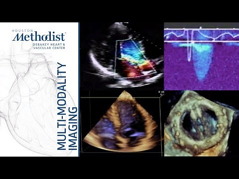 Basic Principles of Echocardiography and Doppler (William A. Zoghbi, MD) September 8, 2020