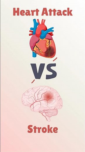 Heart Attack vs Stroke — What’s the Difference?