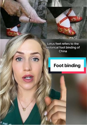 Understanding Lotus Feet: A Cultural Perspective