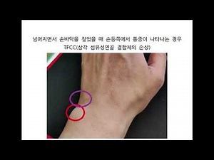 넘어지면서 손목 인대 손상 손목염좌 손목인대 늘어났을때 증상