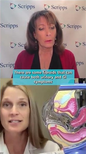 Uterine Fibroids: How to Diagnose and Treat