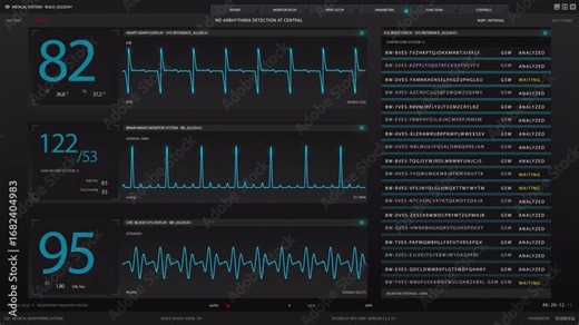 Dynamic Medical Monitoring System Displaying Vital Signs and Real-time Patient Data with ECG Waveforms