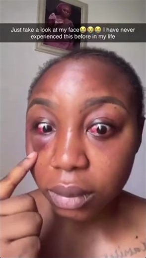 Driver Beats A Lady Over AC Argument (Photos) - Crime - Nairaland