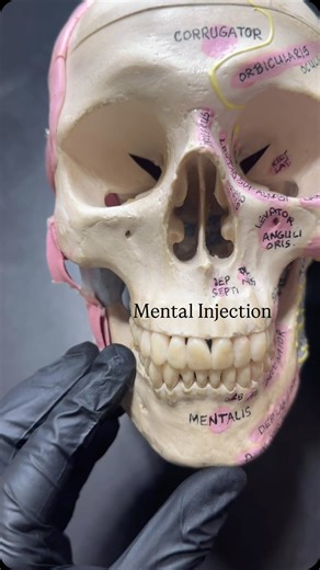 Hygiene Edge on Instagram: "Where on the skull should be aim for the mental injection?"