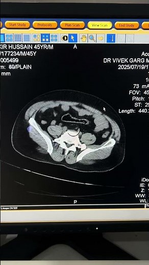 Comment the ct machine scanning artifacts name 😎🫨