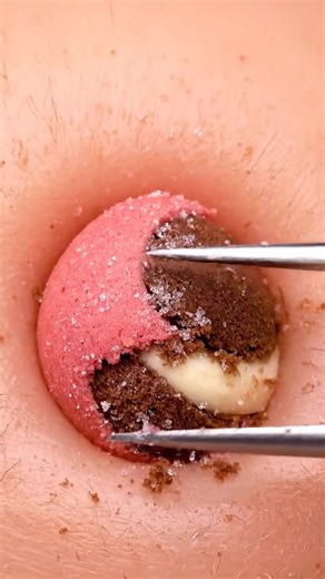 Relax and enjoy these satisfying pops 😴 #ASMR