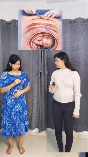 Every C-section scar heals differently, and not every scar looks the same. In the first few weeks, mild pain, itching, numbness, firmness, or slight redness around the incision can be part of normal healing. Over time, the scar usually becomes flatter and lighter in color. However, increasing redness, swelling, pus, foul-smelling discharge, severe pain, fever, the wound opening, or heavy bleeding are warning signs that should never be ignored and require prompt medical attention. To support heal
