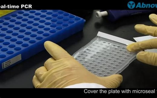 实时定量荧光PCR（Real-time PCR）