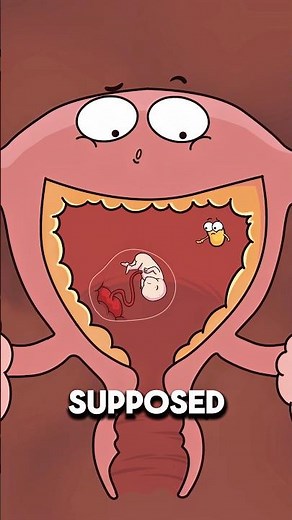 When a Mom Gets Pregnant Twice at Once 🤰👶..!!#e2dhealth #animation #2dshow #fypシ #health