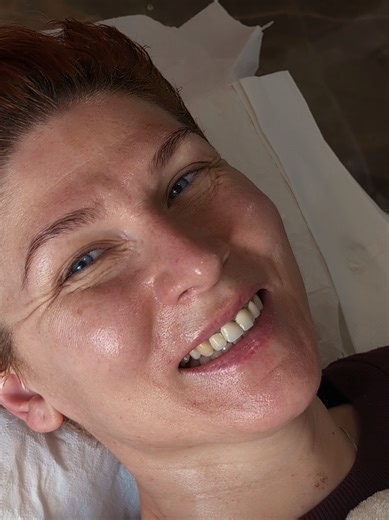 Understanding Client Needs in Skincare Treatments