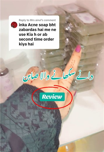 Acne Soap Review: Transform Your Skin Today