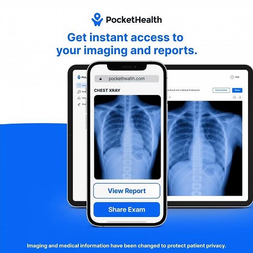 Joanne uses PocketHealth to get a better understanding of her reports