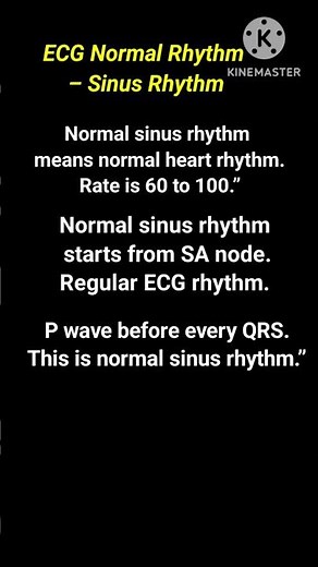 Normal Sinus Rhythm (ECG Basics)What is Normal Sinus Rhythm?