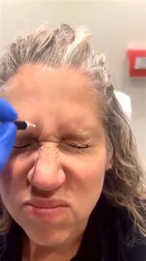 Learn more about how to find Botox dealsand pricing | Professional Service