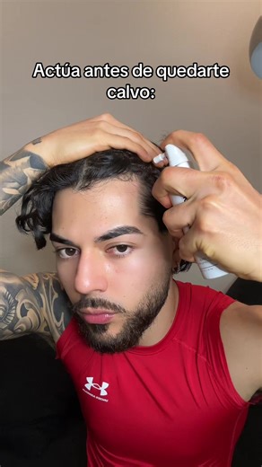 Nanoxidil 5 Uses with Dermaroller for Hair Growth