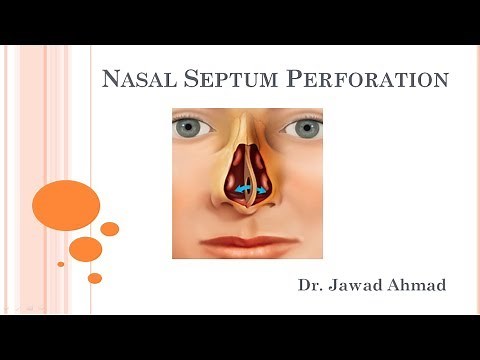 Nasal Septum Perforation -Explained for Medical Students
