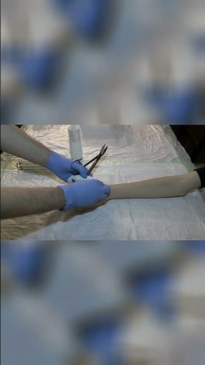 🇮🇹 Bendaggio Tubolare per Dita della Mano. 🇬🇧 Bandage for Fingers of the Hand