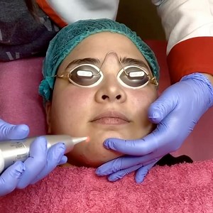 39K views · 113 reactions | LAST DAY TODAY REVLITE PROMO 10...