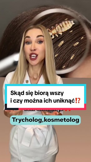Skąd się biorą wszy i jak można ich uniknąć?