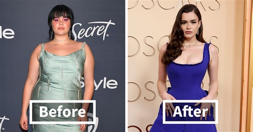 “Everything About Her Is Plastic And Fake”: Fans Brutally Roast 10 Celeb Appearances At The 2026 Oscars